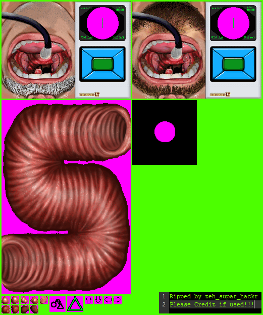 Bronchoscopy